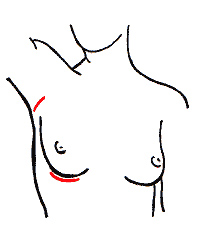 Brustvergrößerung - Operationsverfahren